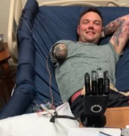 Alt-Bionics利用3D打印推动高性能仿生假肢低成本与模块化设计