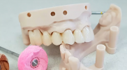 牙科领域：SLA、DLP和LCD树脂3D打印对比