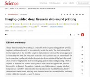 Science顶刊：图像引导的深部组织体内声音打印技术（DISP），无须侵入性手术！