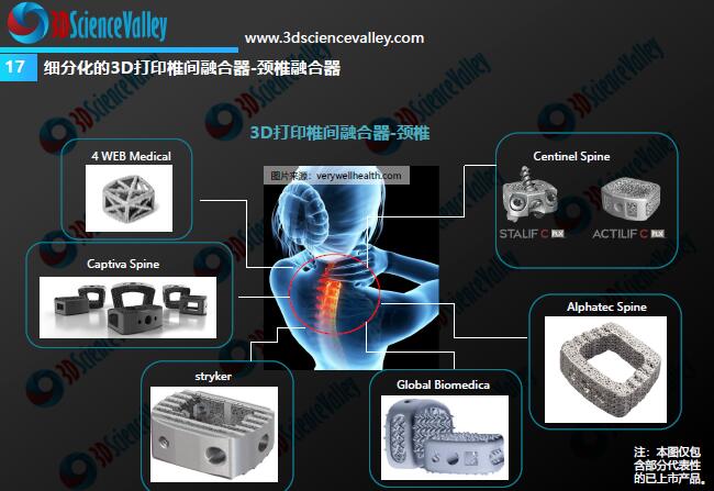 Whitepaper_Orthopedic Implant_17